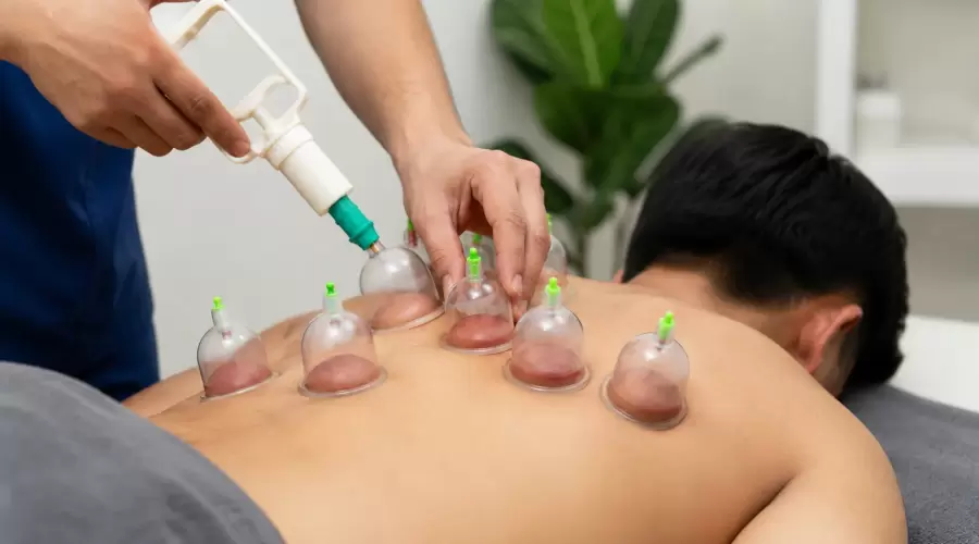 Cupping Therapy